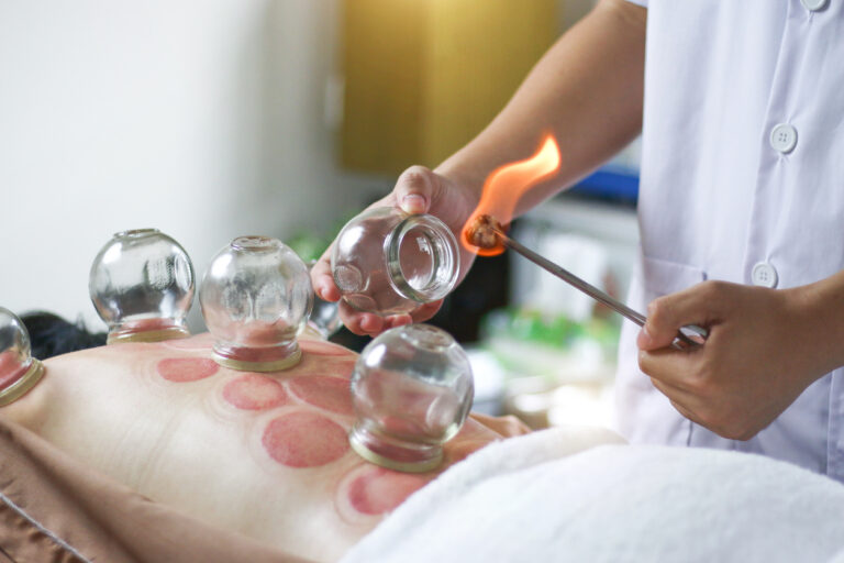 Cursus Vuur Cuppen (Fire Cupping)