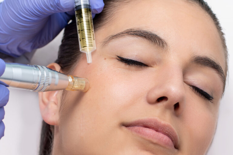 Online Cursus Microneedling