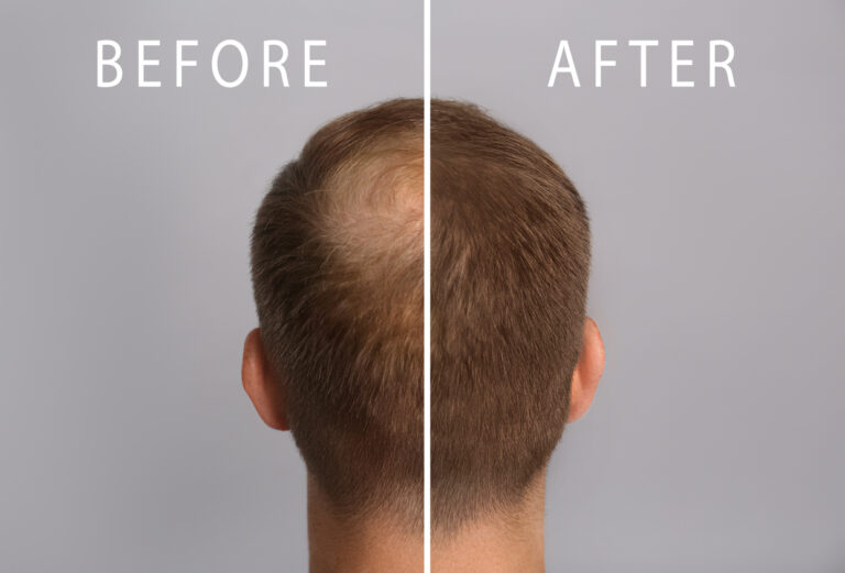Praktijktraining Haarbooster
