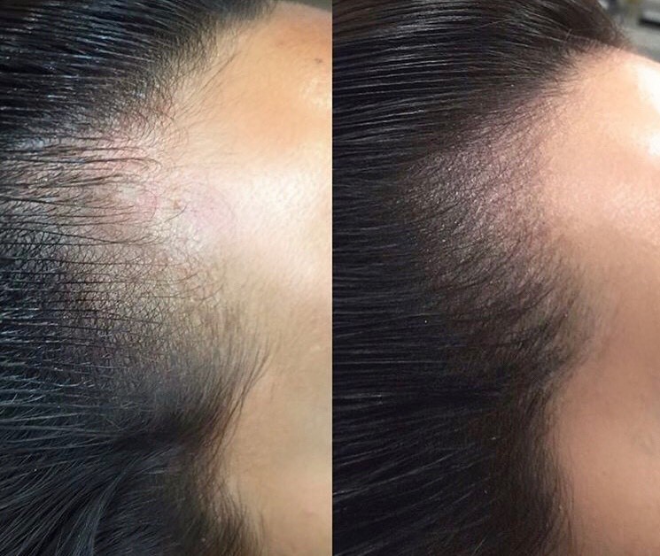 Startpakket microhaarshading