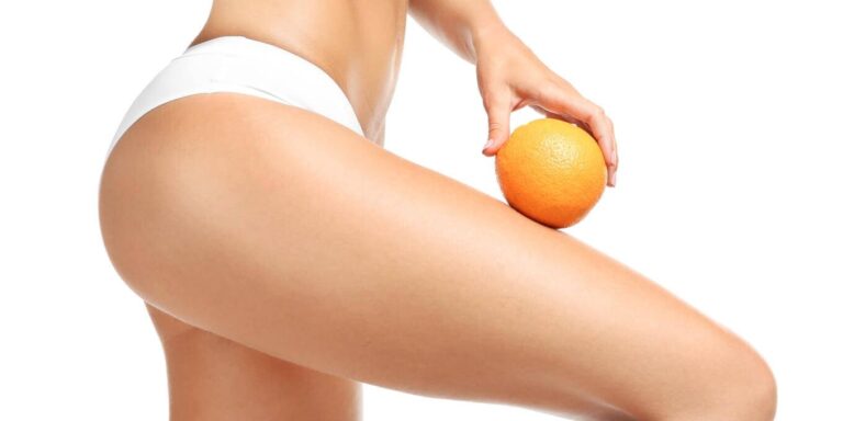 Startpakket Cellulite